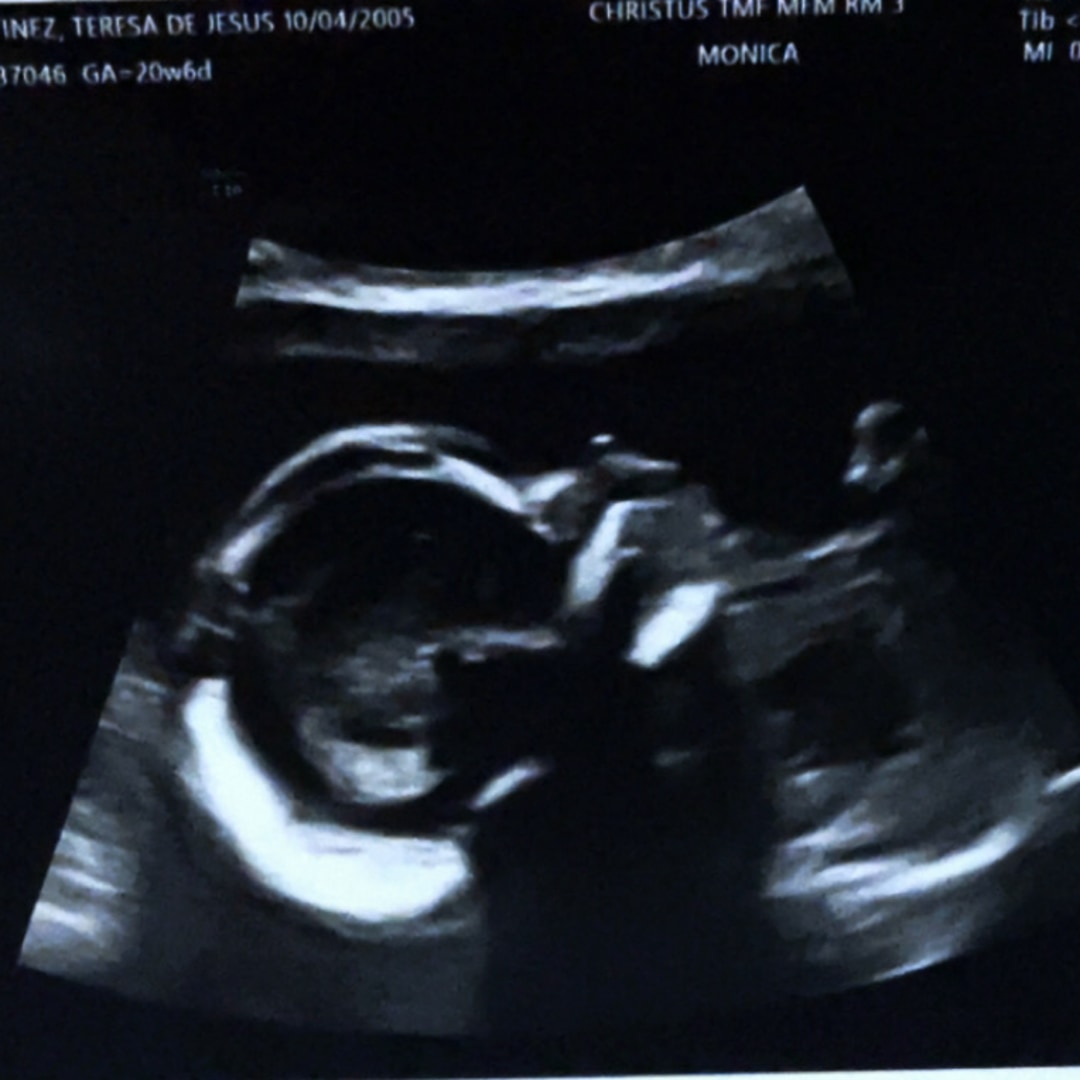 Photo shared by Teresa for their Babylist baby registry.