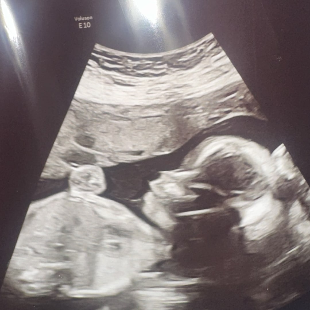 Photo shared by Melissa for their Babylist baby registry.