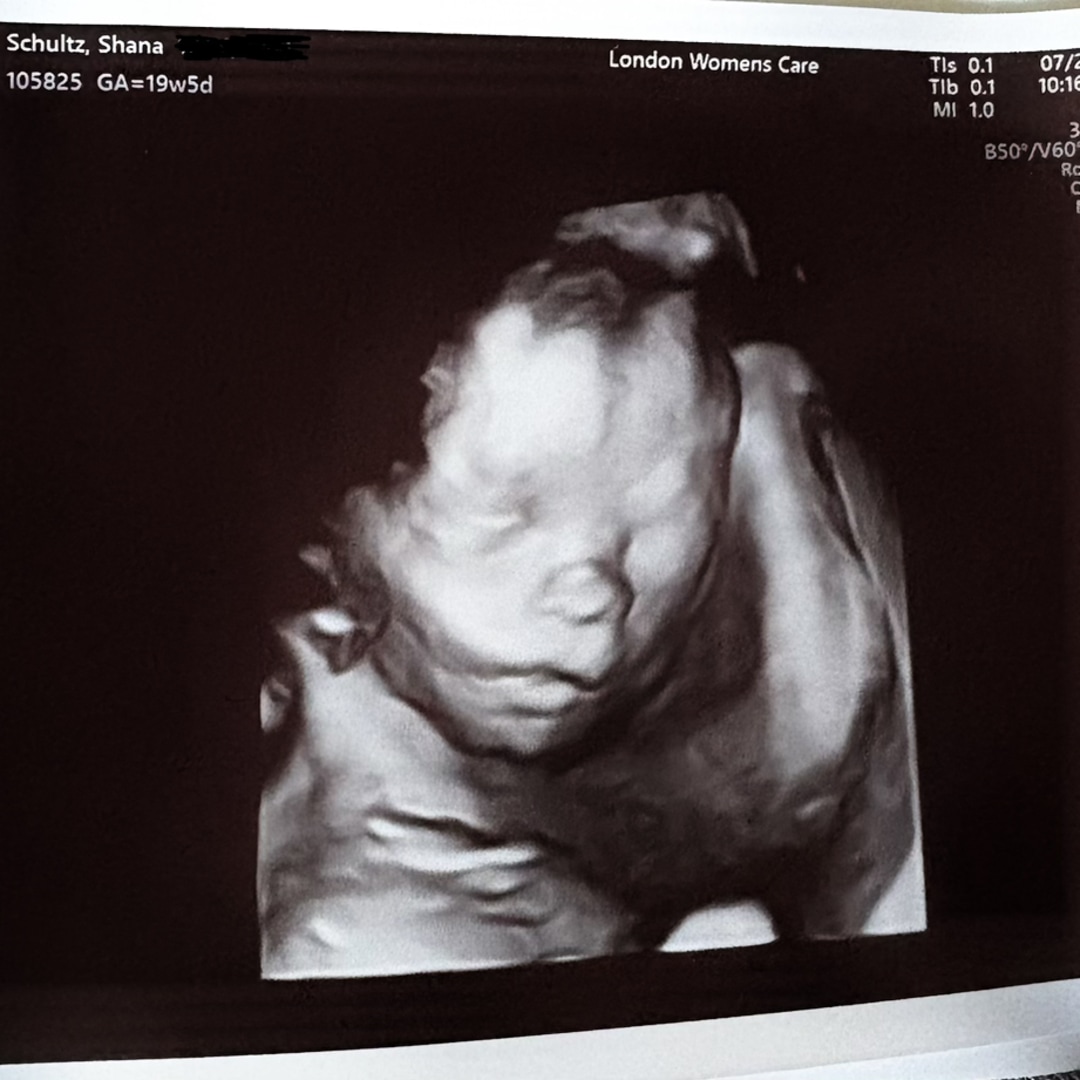 Photo shared by Shana for their Babylist baby registry.