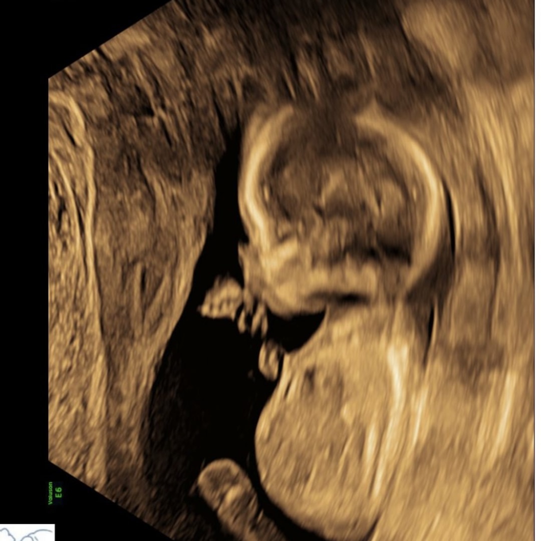 Photo shared by Paris for their Babylist baby registry.