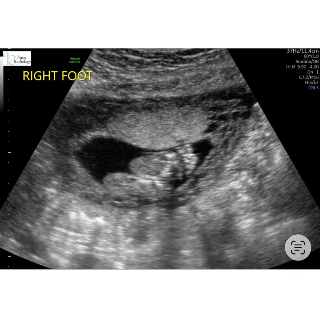 Photo shared by Lizzie for their Babylist baby registry.