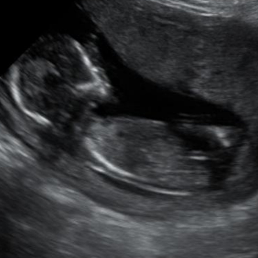 Photo shared by Dayana for their Babylist baby registry.