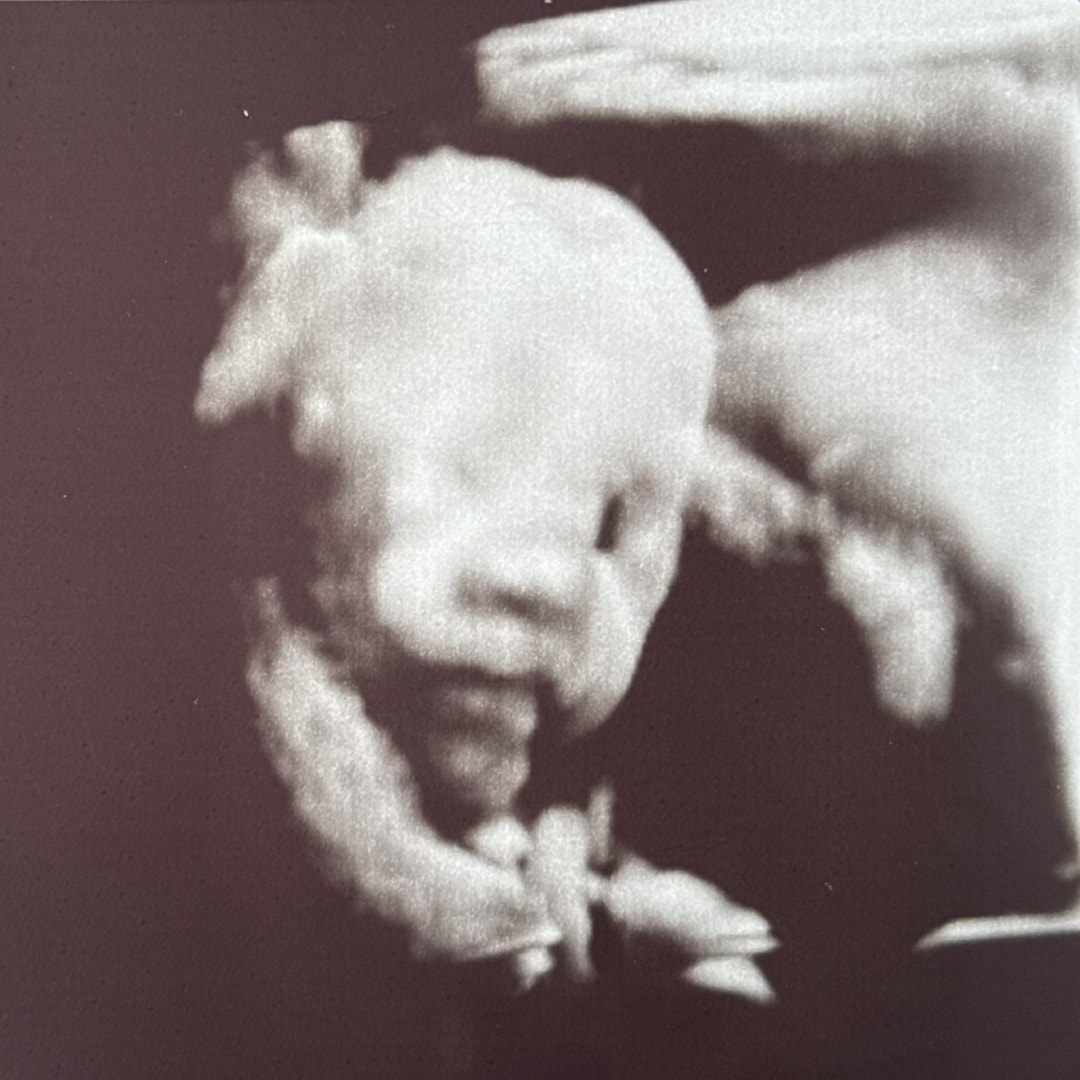 Photo shared by Jaylin for their Babylist baby registry.