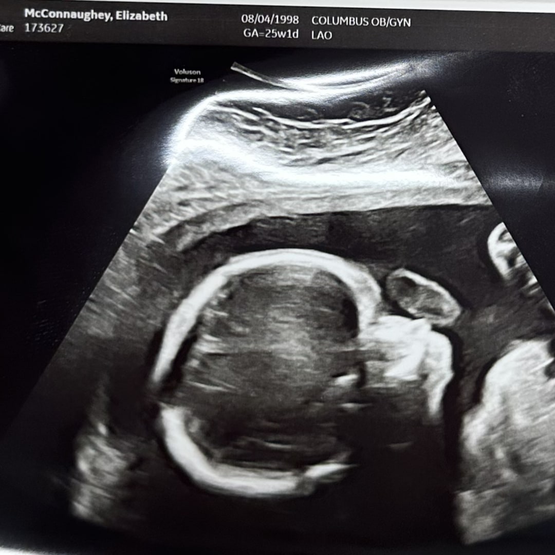 Photo shared by Liz for their Babylist baby registry.