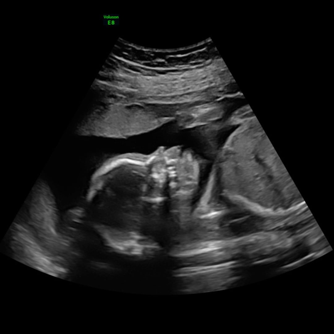 Photo shared by Audrey for their Babylist baby registry.