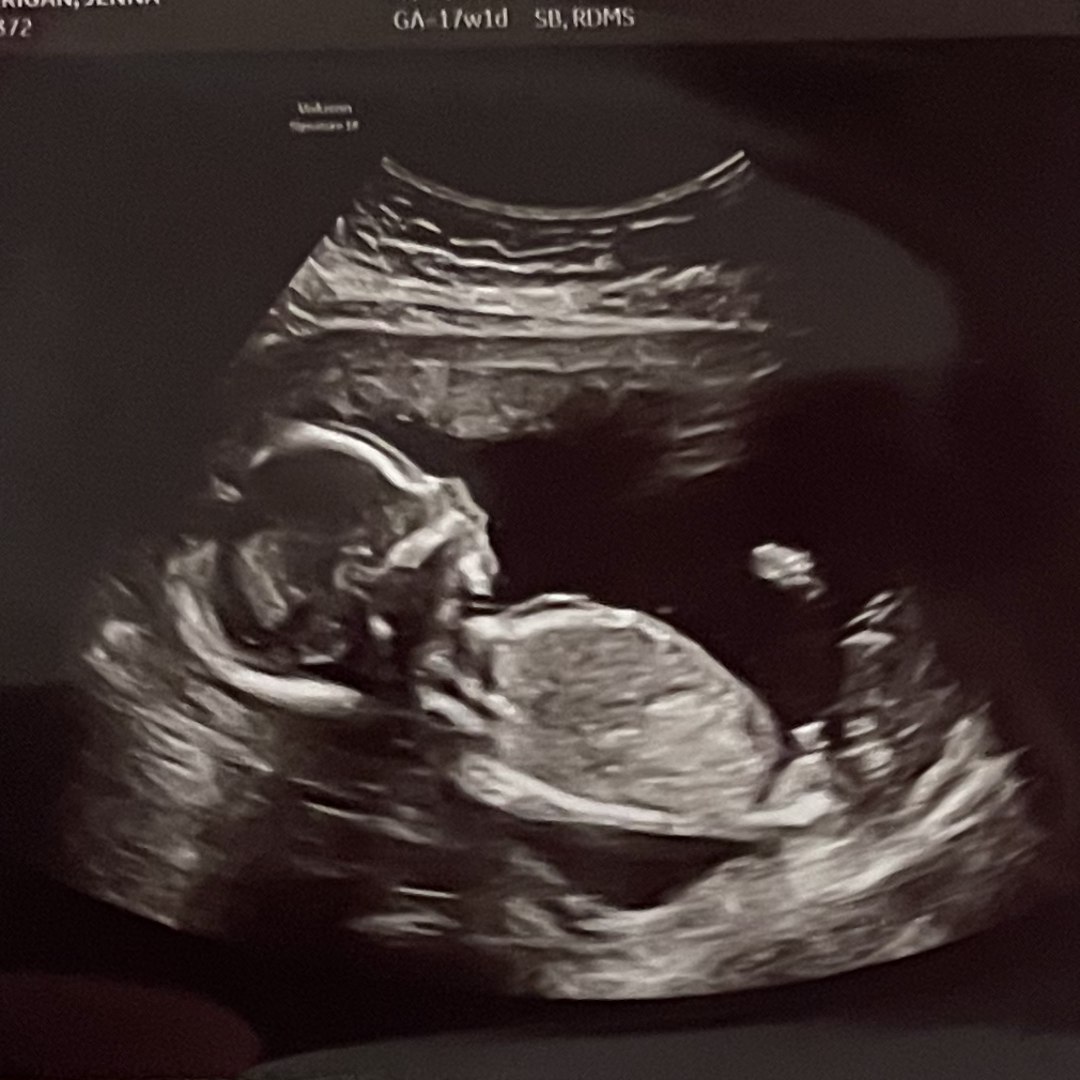 Photo shared by Jenna for their Babylist baby registry.