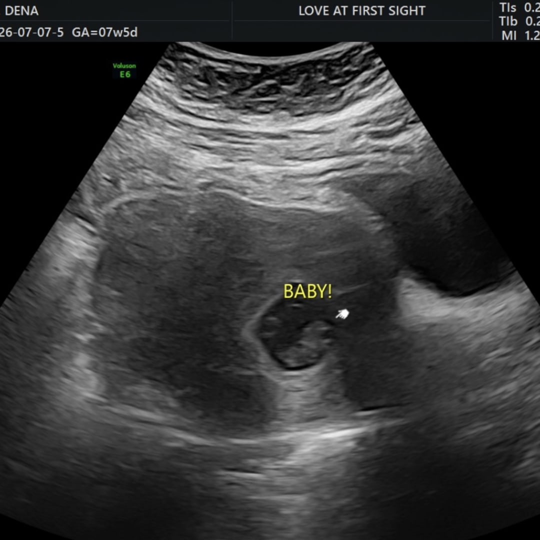 Photo shared by Dena for their Babylist baby registry.