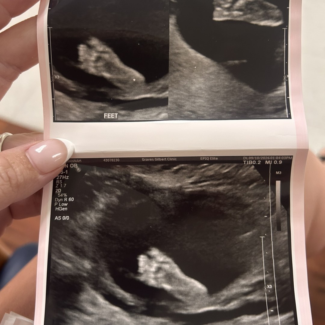 Photo shared by Savannah for their Babylist baby registry.