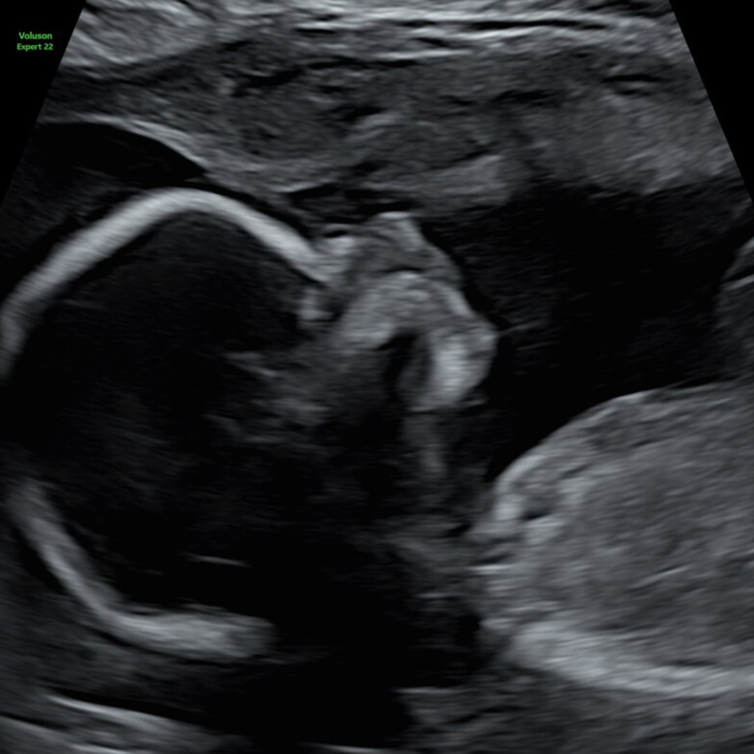 Photo shared by Sarah for their Babylist baby registry.