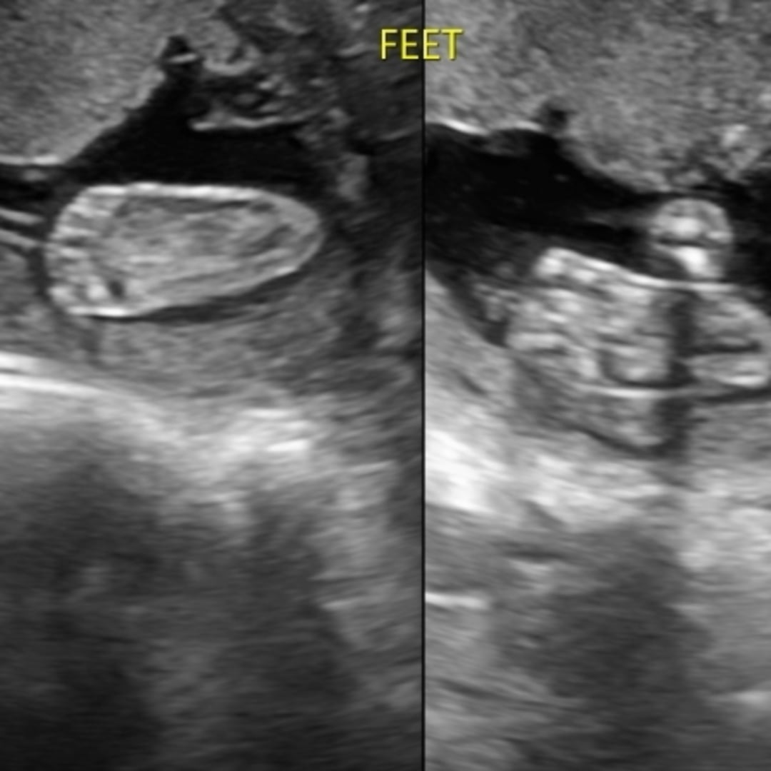 Photo shared by Audrey for their Babylist baby registry.