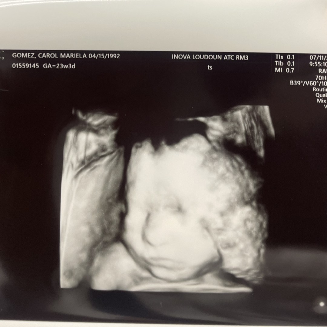 Photo shared by Carol for their Babylist baby registry.