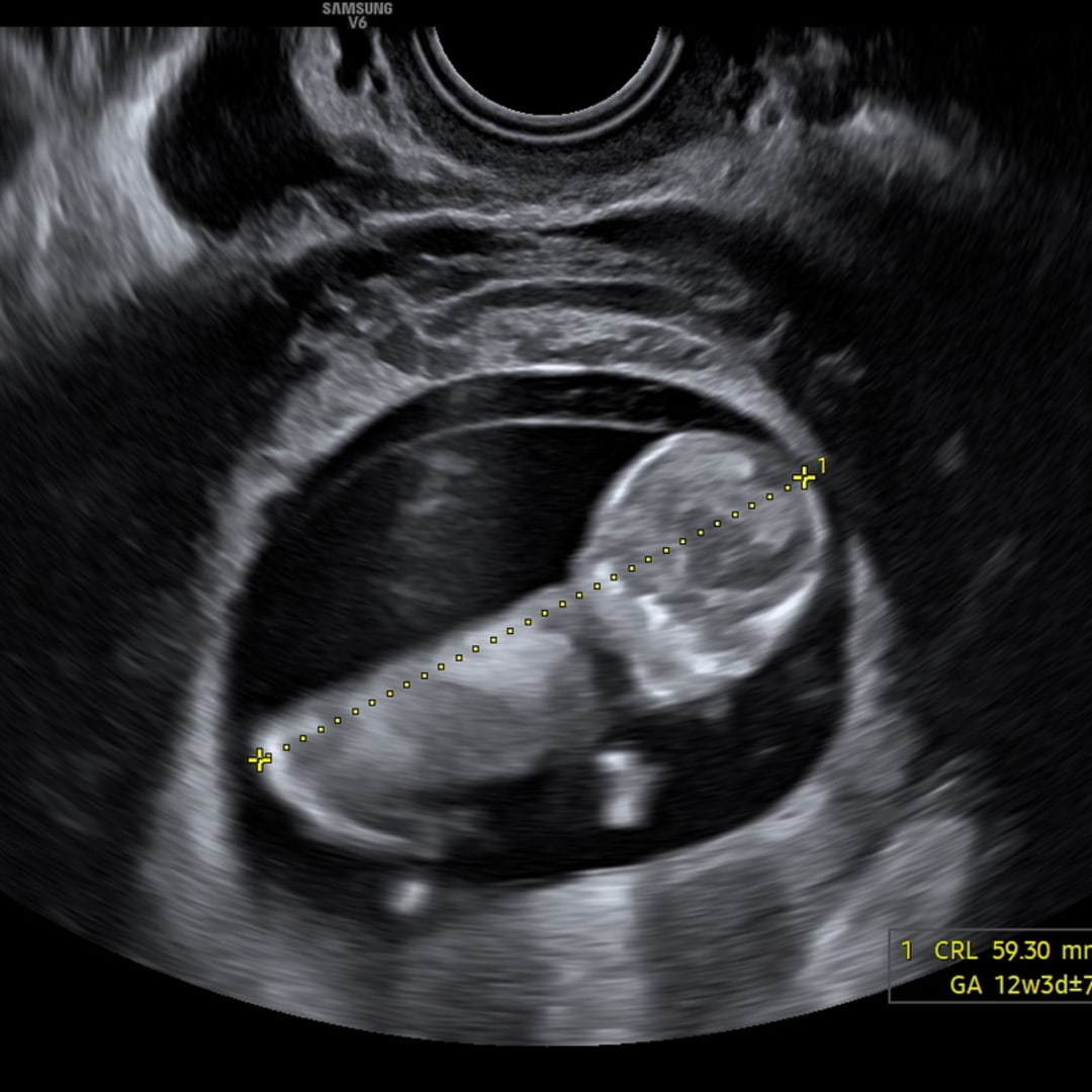 Photo shared by Savanna for their Babylist baby registry.