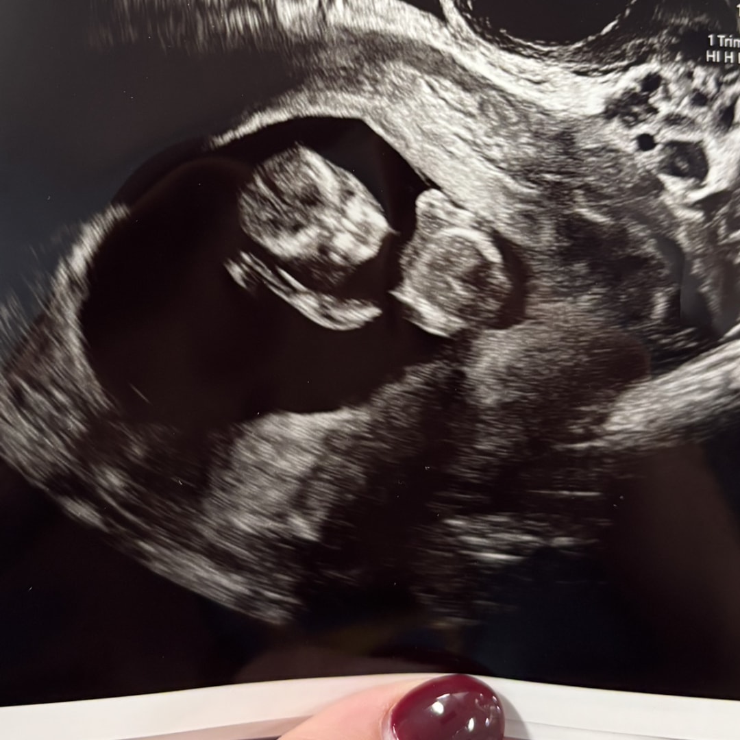 Photo shared by Katelyn for their Babylist baby registry.