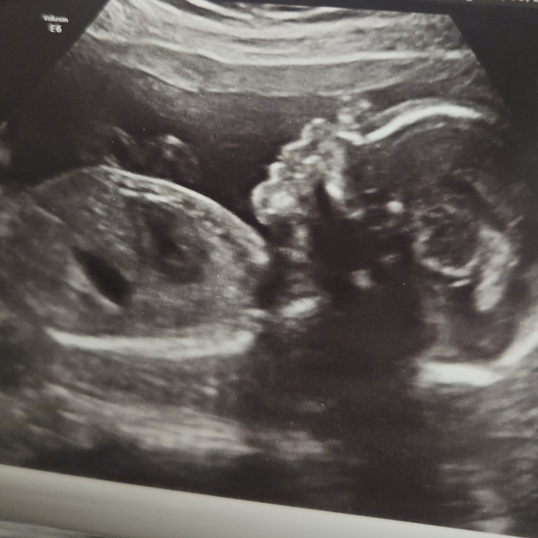 Photo shared by Gabriella for their Babylist baby registry.