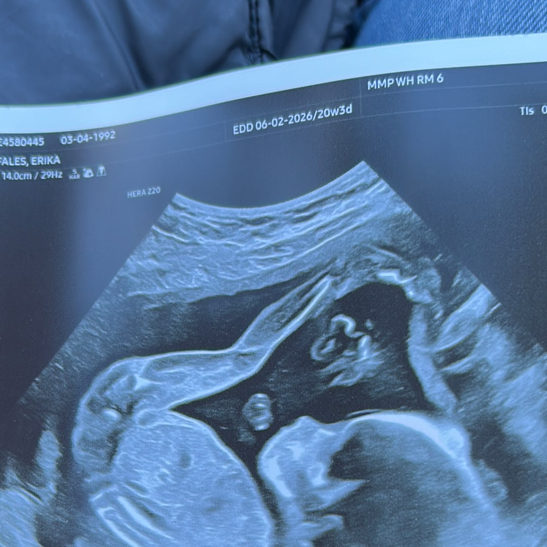 Photo shared by Erika for their Babylist baby registry.