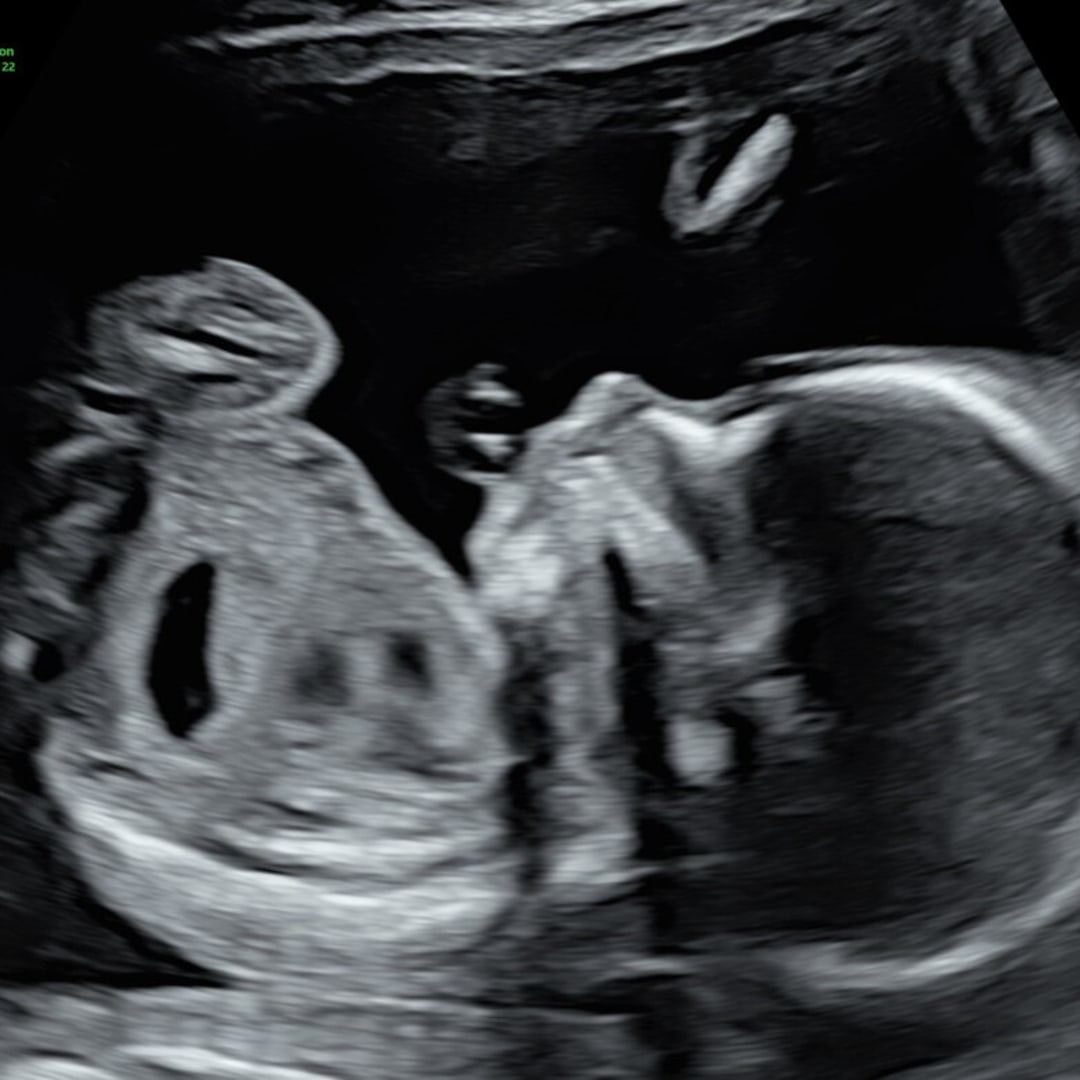 Photo shared by Teresa for their Babylist baby registry.