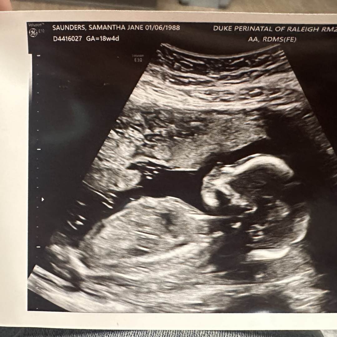 Photo shared by Samantha for their Babylist baby registry.