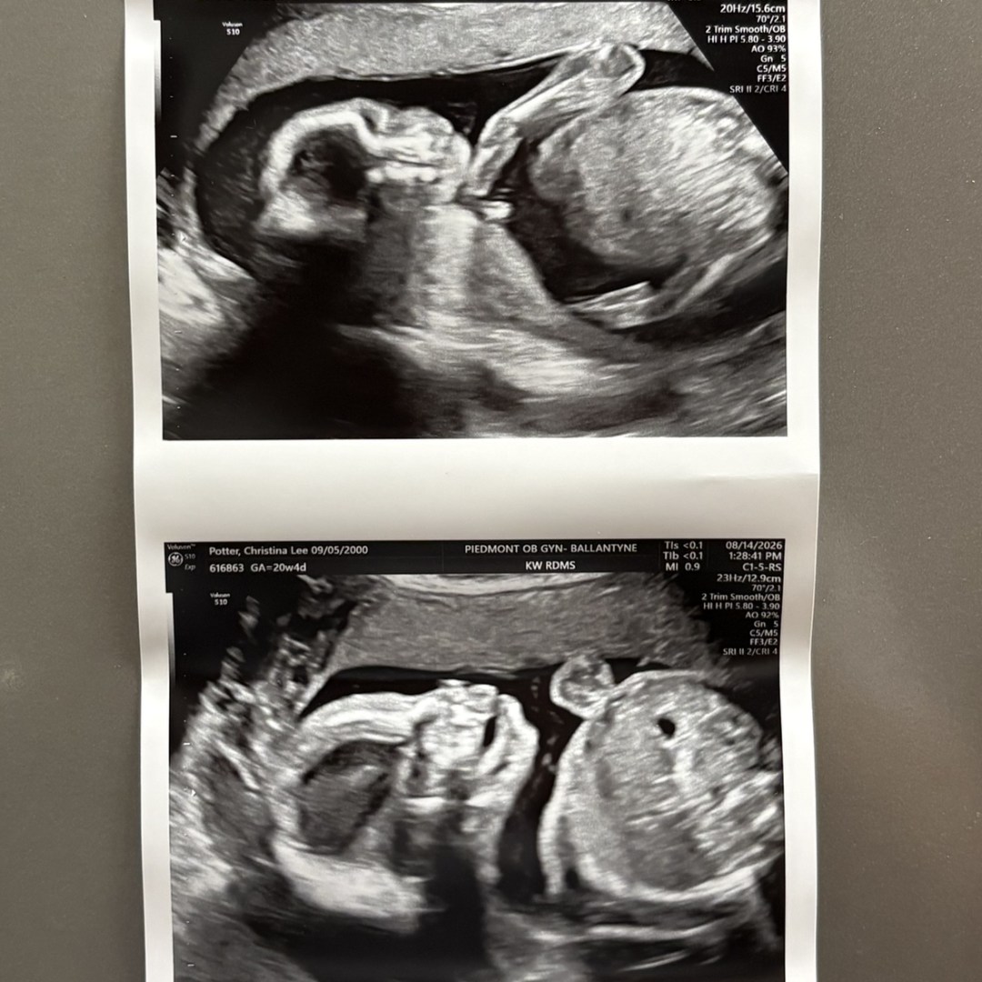 Photo shared by Justin for their Babylist baby registry.