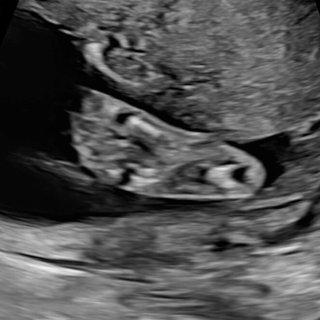 Photo shared by Rosetta for their Babylist baby registry.