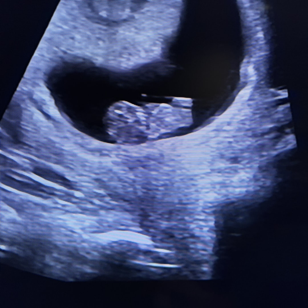 Photo shared by Montanna for their Babylist baby registry.