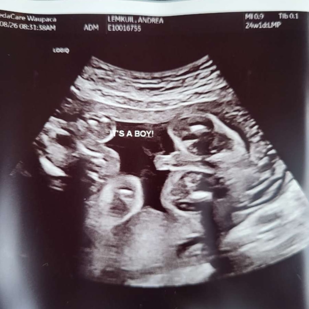 Photo shared by Andrea for their Babylist baby registry.