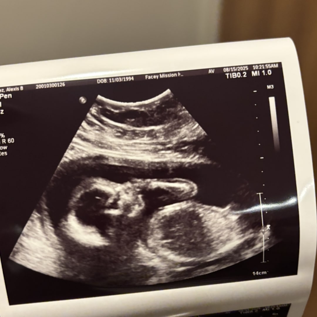 Photo shared by Alexis for their Babylist baby registry.
