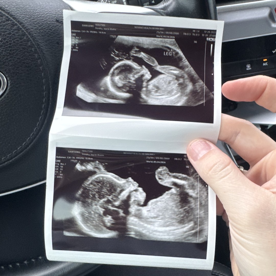 Photo shared by Jaycie for their Babylist baby registry.