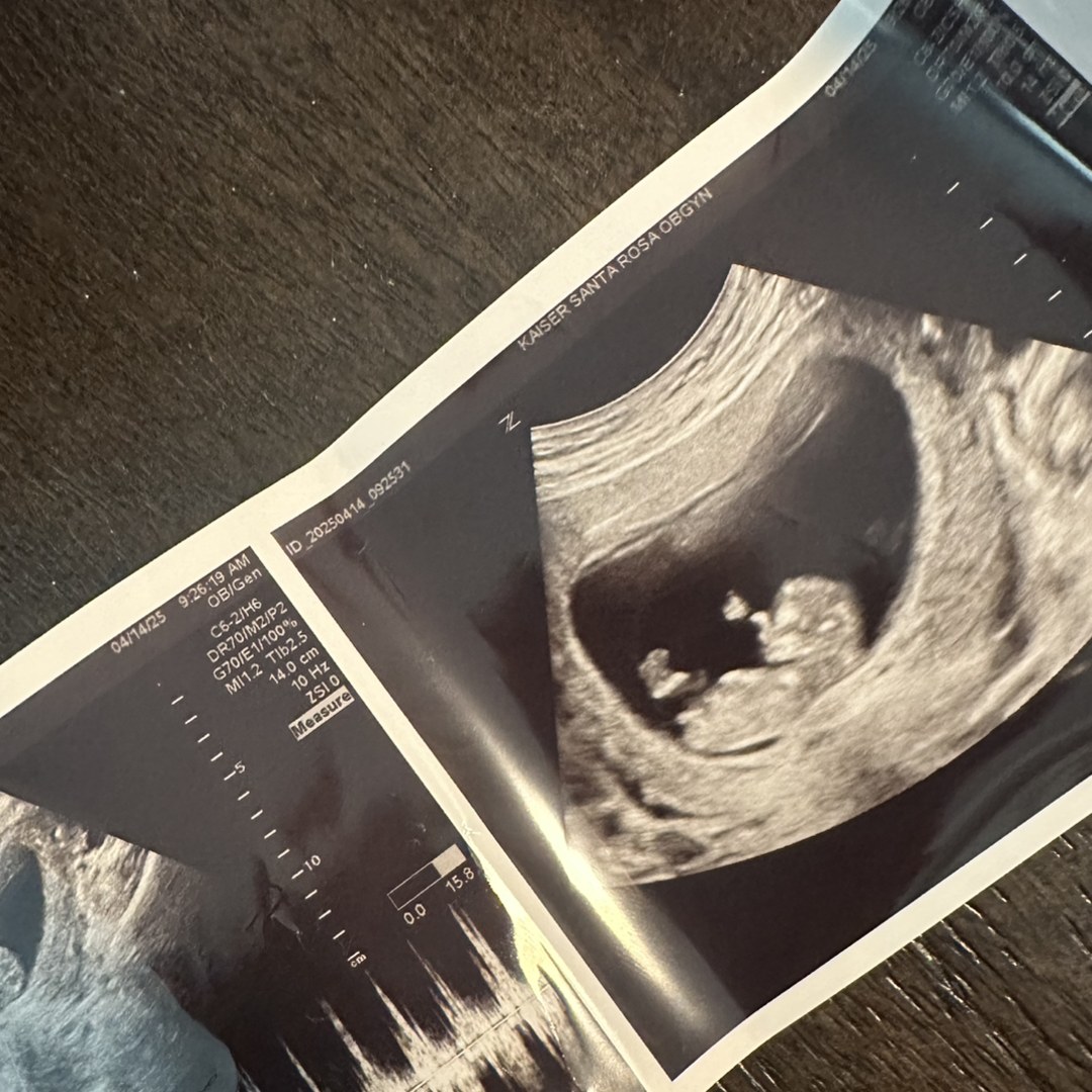 Photo shared by Audrey for their Babylist baby registry.