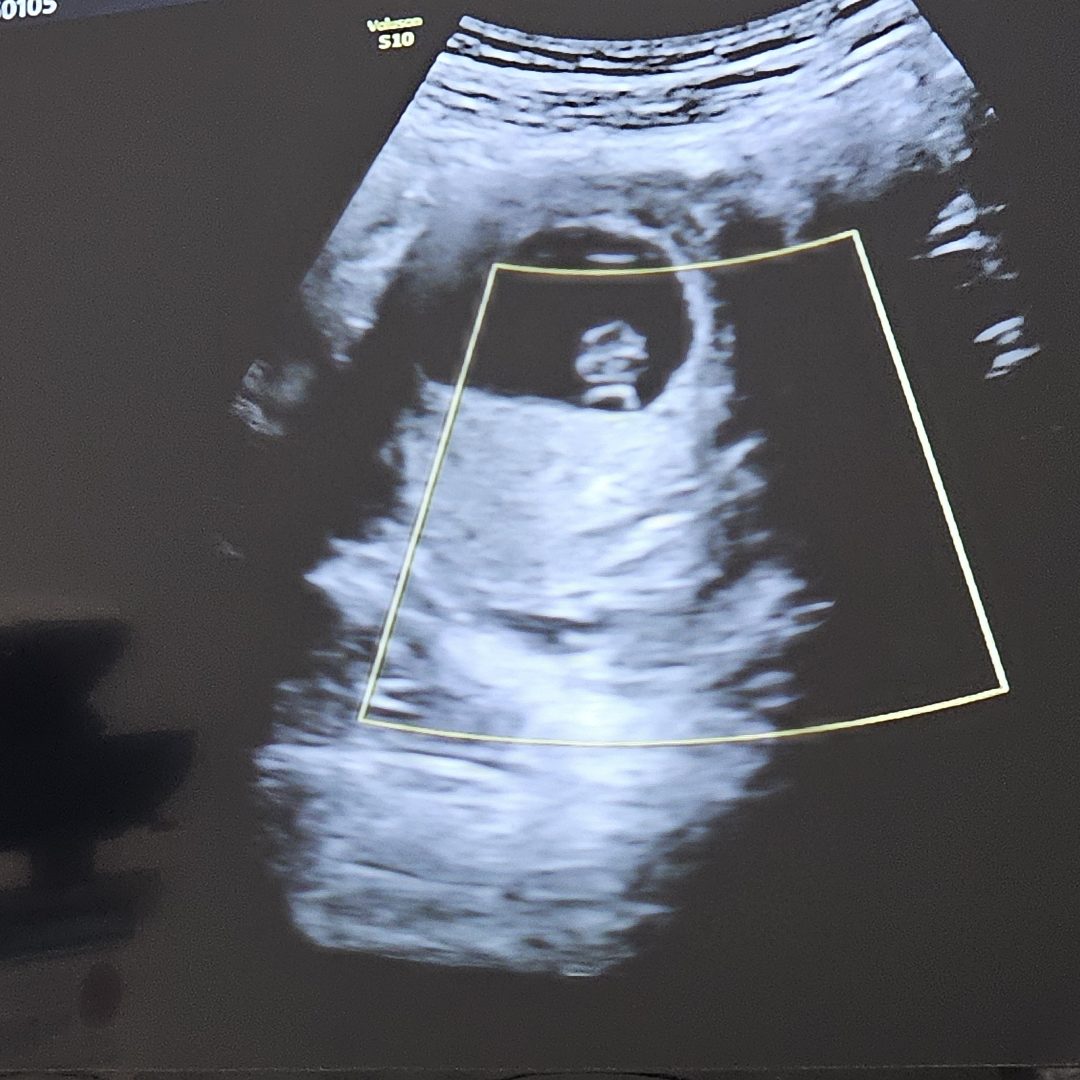 Photo shared by Jonelle for their Babylist baby registry.