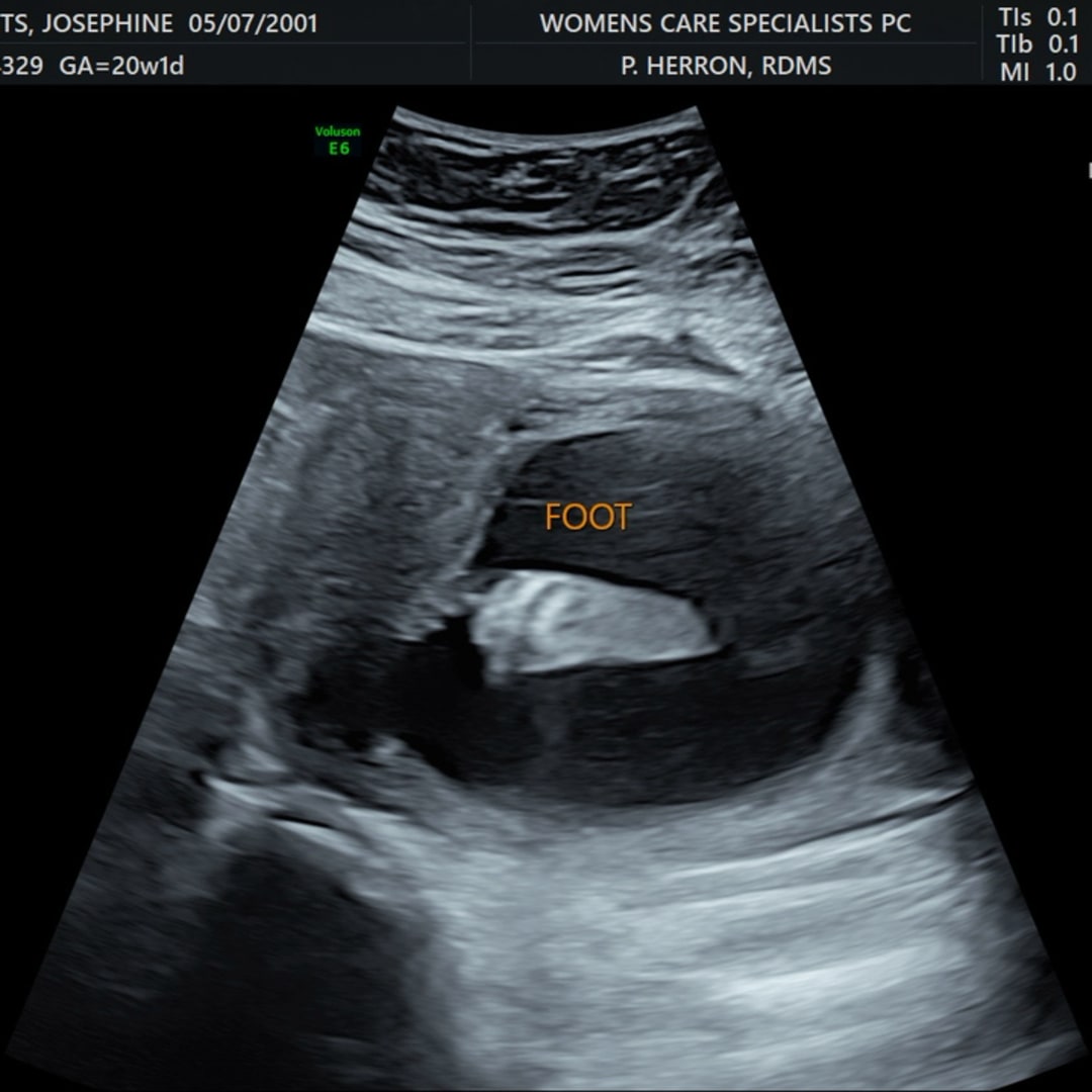 Photo shared by Josie for their Babylist baby registry.