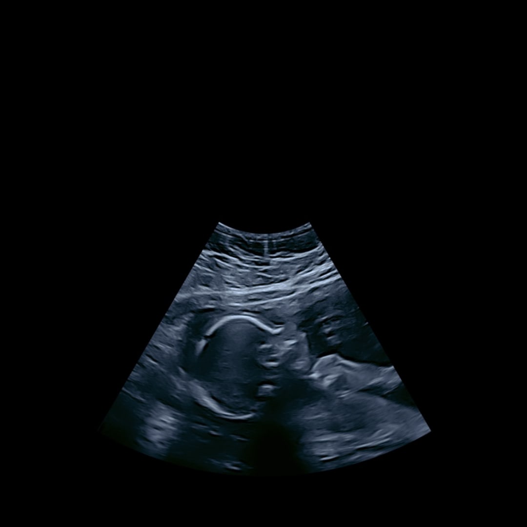 Photo shared by Ivey for their Babylist baby registry.