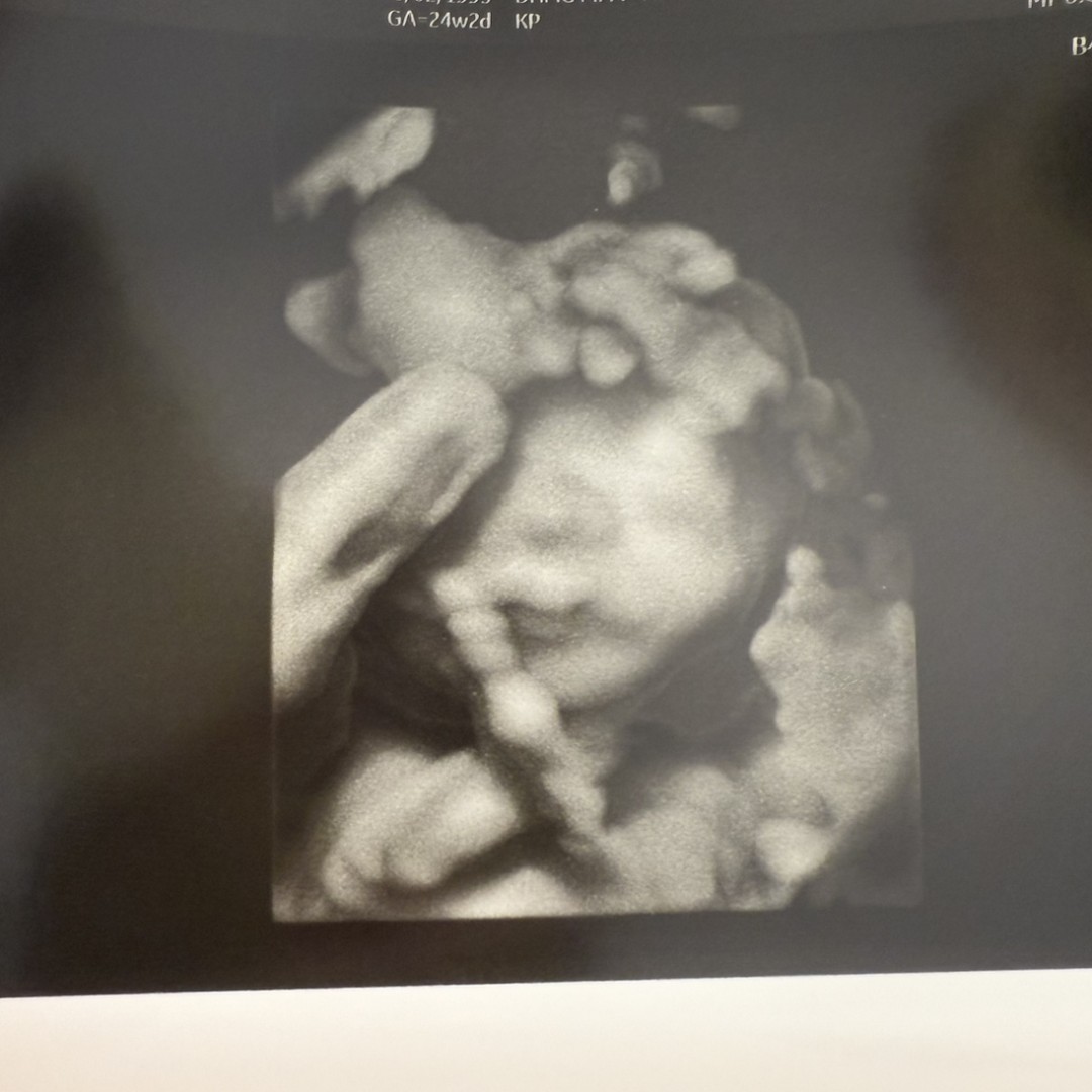 Photo shared by Dusty for their Babylist baby registry.