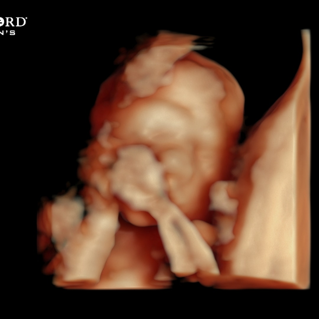 Photo shared by Alexis for their Babylist baby registry.