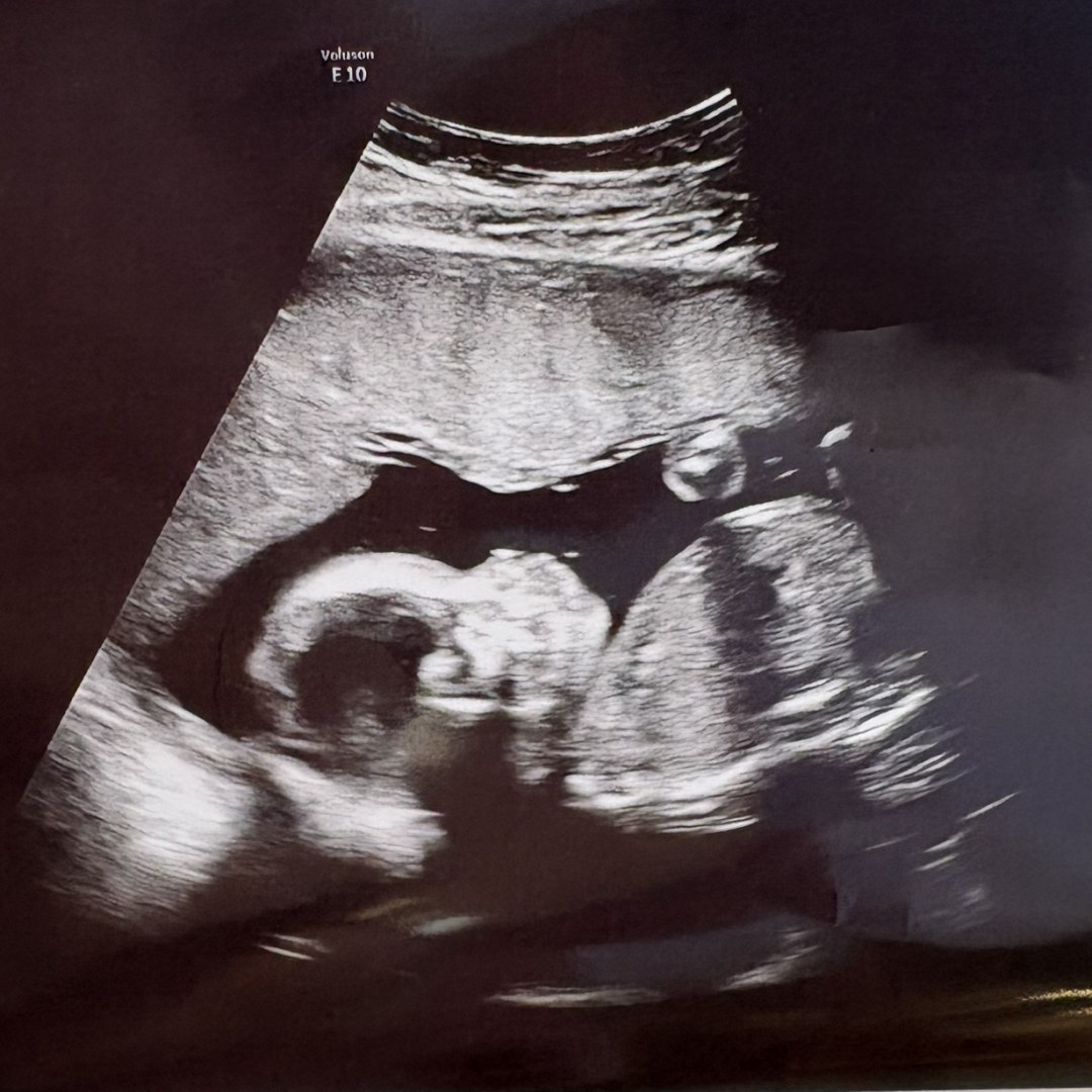 Photo shared by Janavia for their Babylist baby registry.