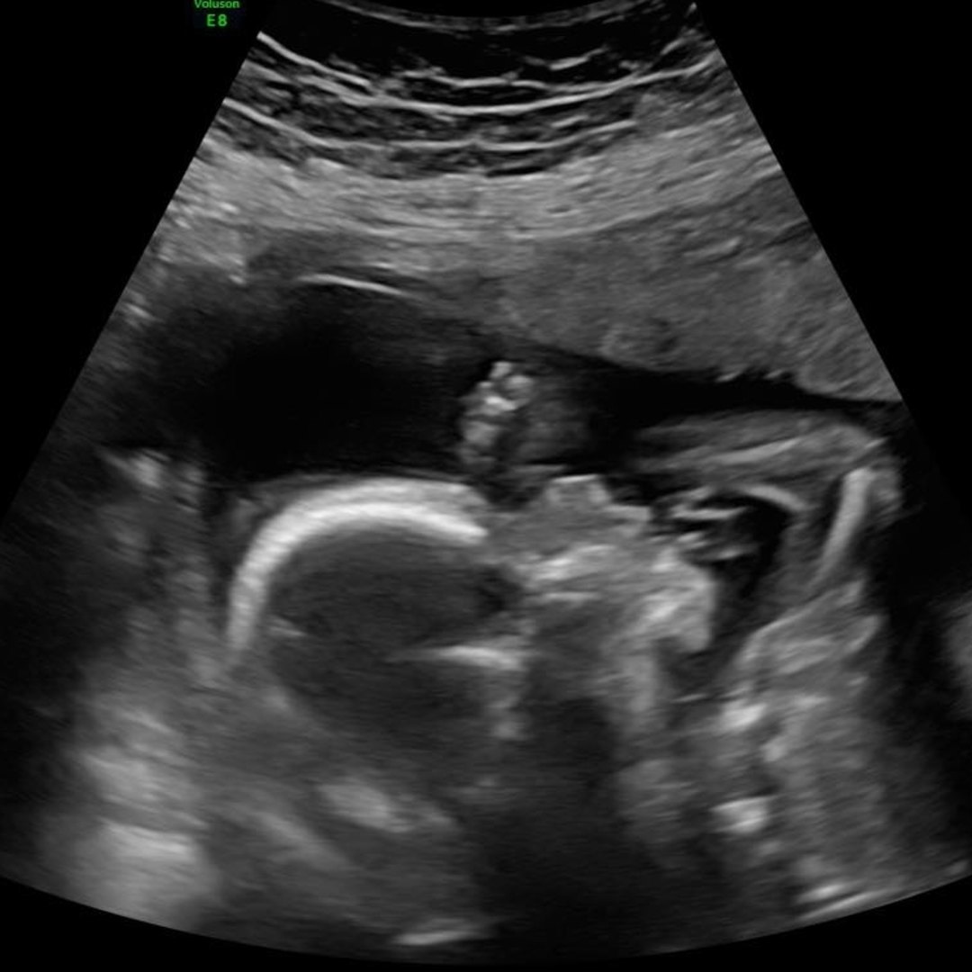 Photo shared by Cheyenne for their Babylist baby registry.