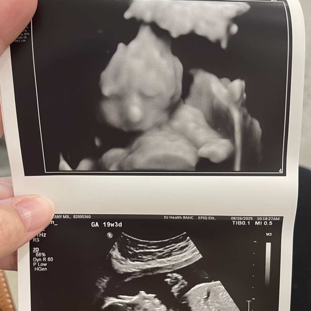 Photo shared by Brittany for their Babylist baby registry.