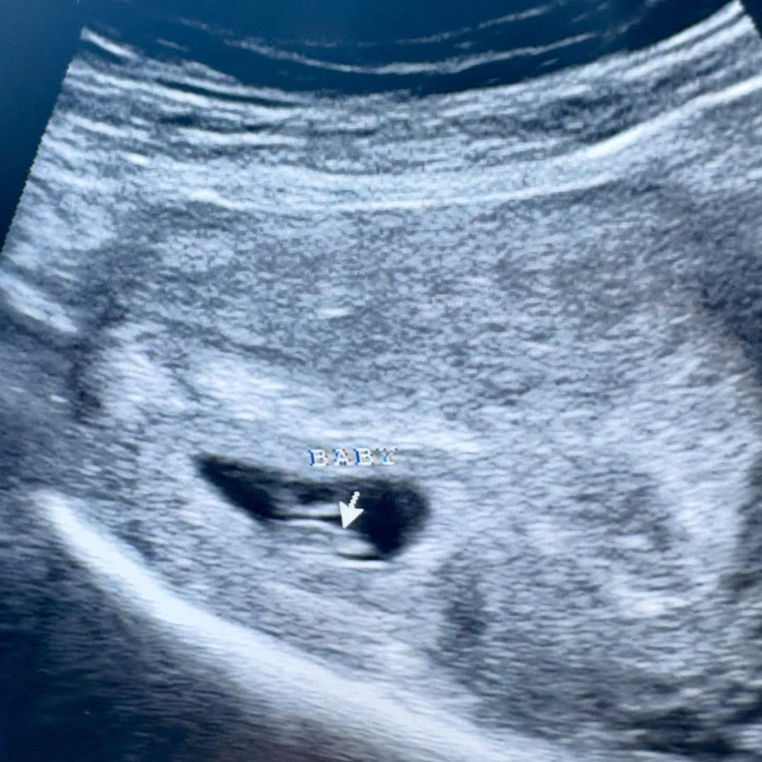 Photo shared by Hannah for their Babylist baby registry.