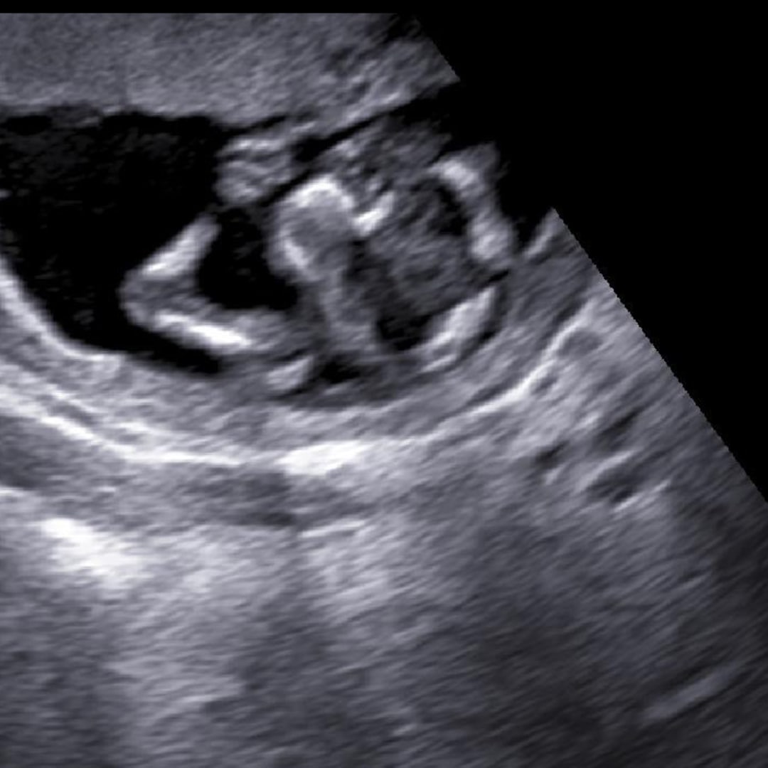 Photo shared by Lexi for their Babylist baby registry.