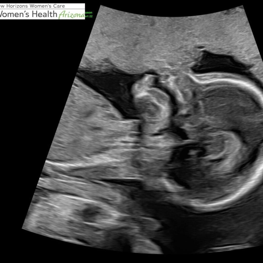 Photo shared by Ahnna for their Babylist baby registry.