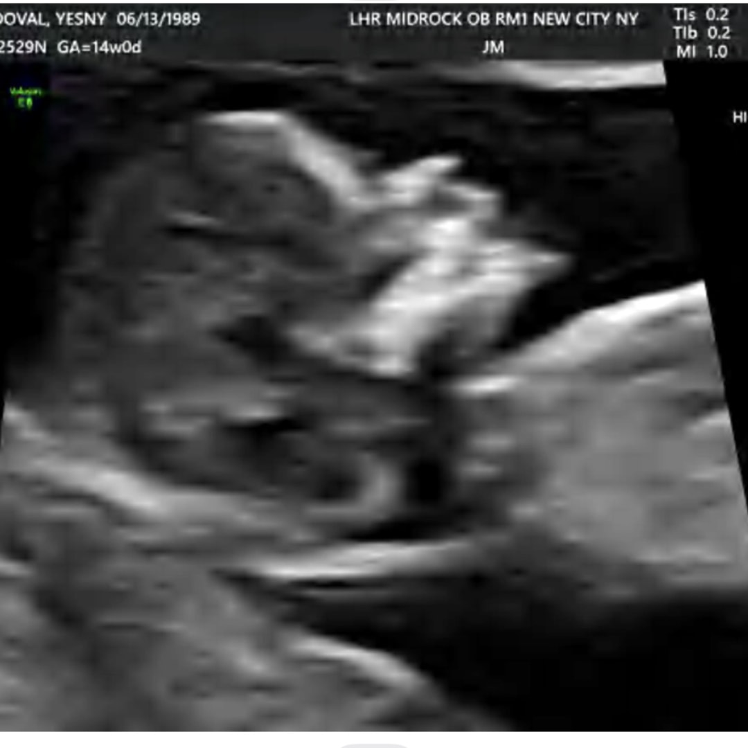 Photo shared by Yesny for their Babylist baby registry.