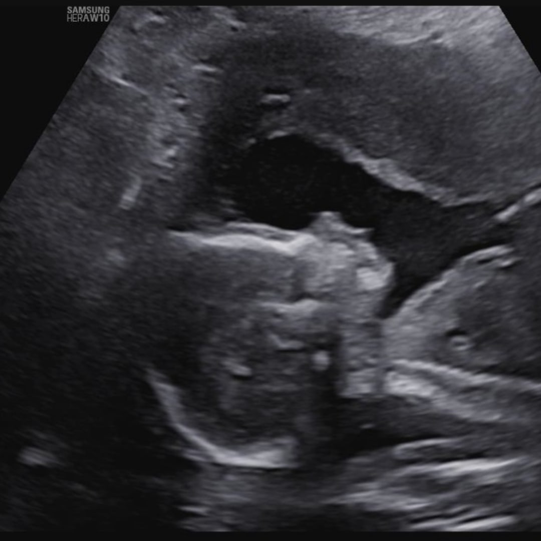 Photo shared by Rebecca for their Babylist baby registry.