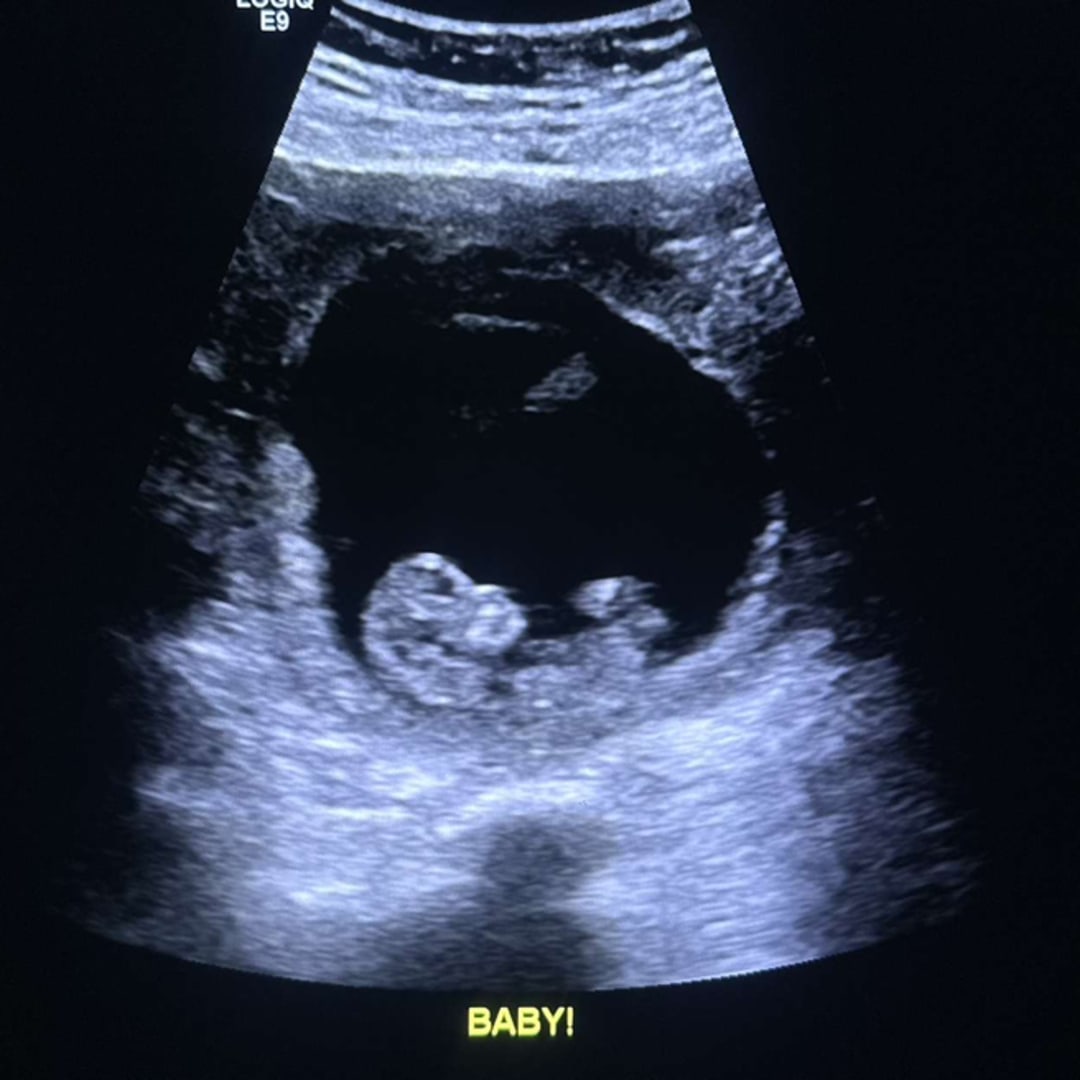 Photo shared by Lacey for their Babylist baby registry.