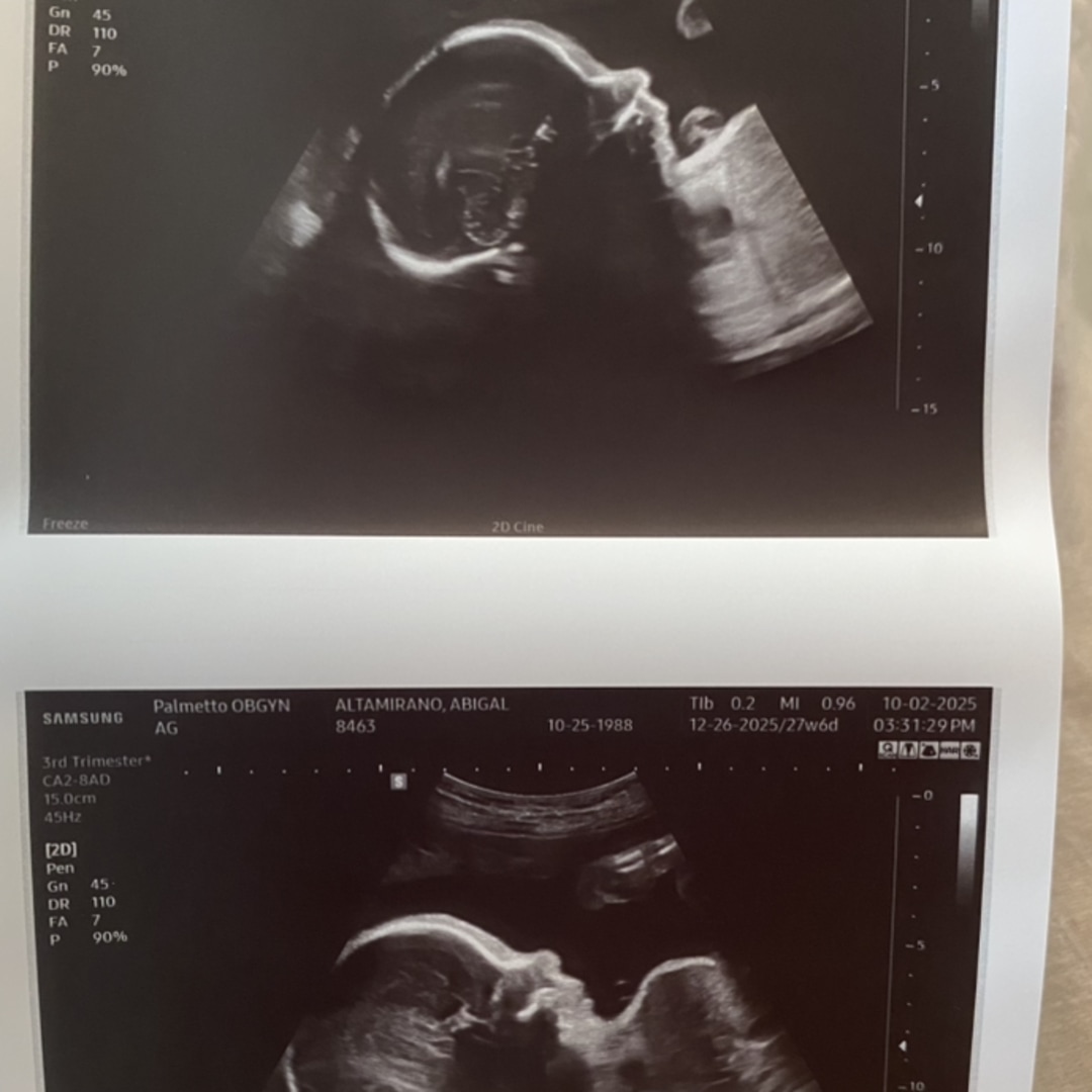 Photo shared by Abigail for their Babylist baby registry.