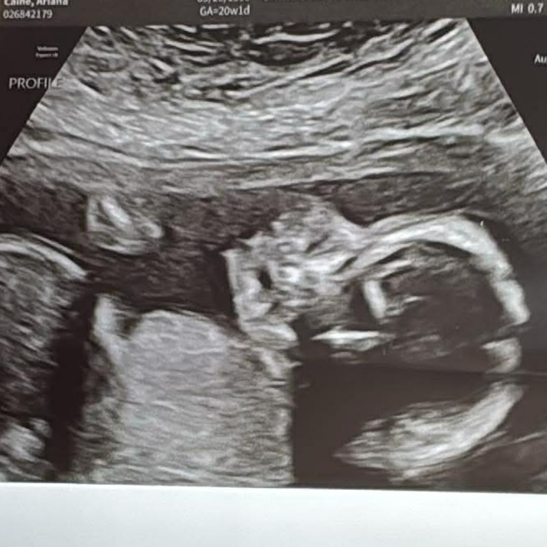 Photo shared by Ariana for their Babylist baby registry.