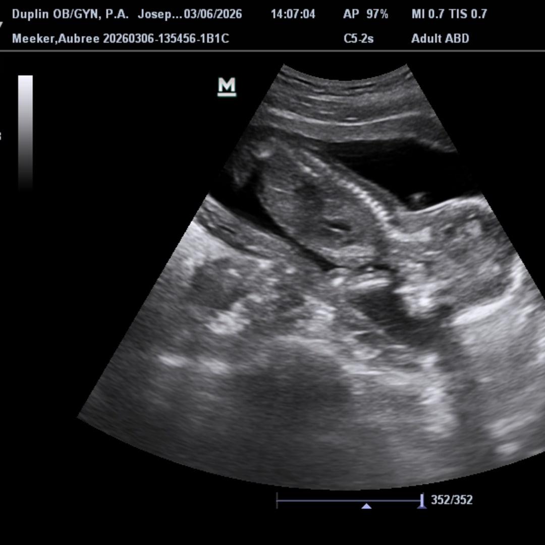 Photo shared by Aubree for their Babylist baby registry.