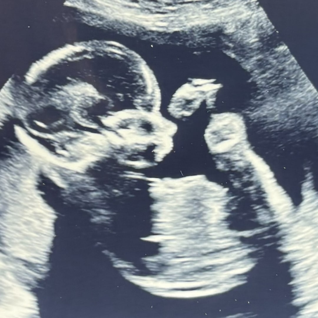 Photo shared by Amira for their Babylist baby registry.