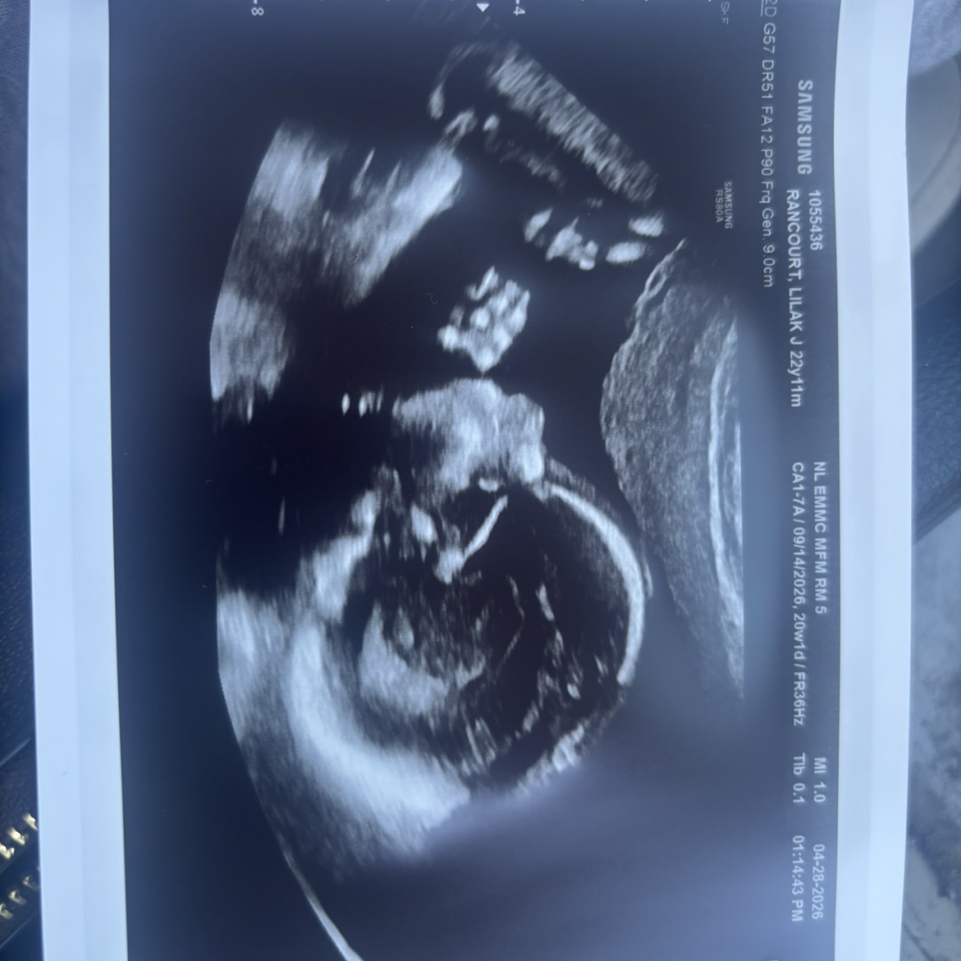 Photo shared by Lilak for their Babylist baby registry.