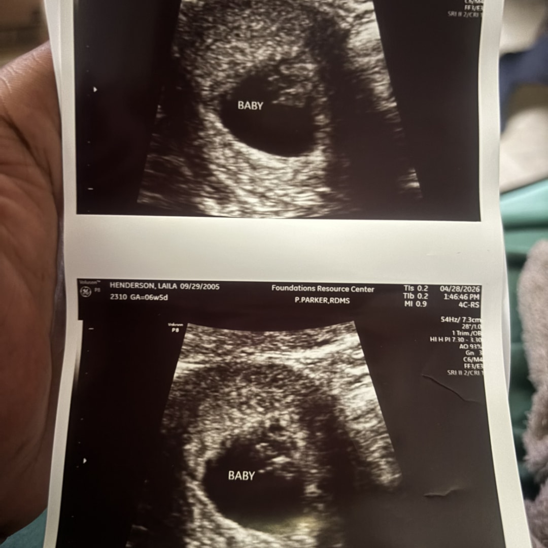 Photo shared by Jacolbie for their Babylist baby registry.