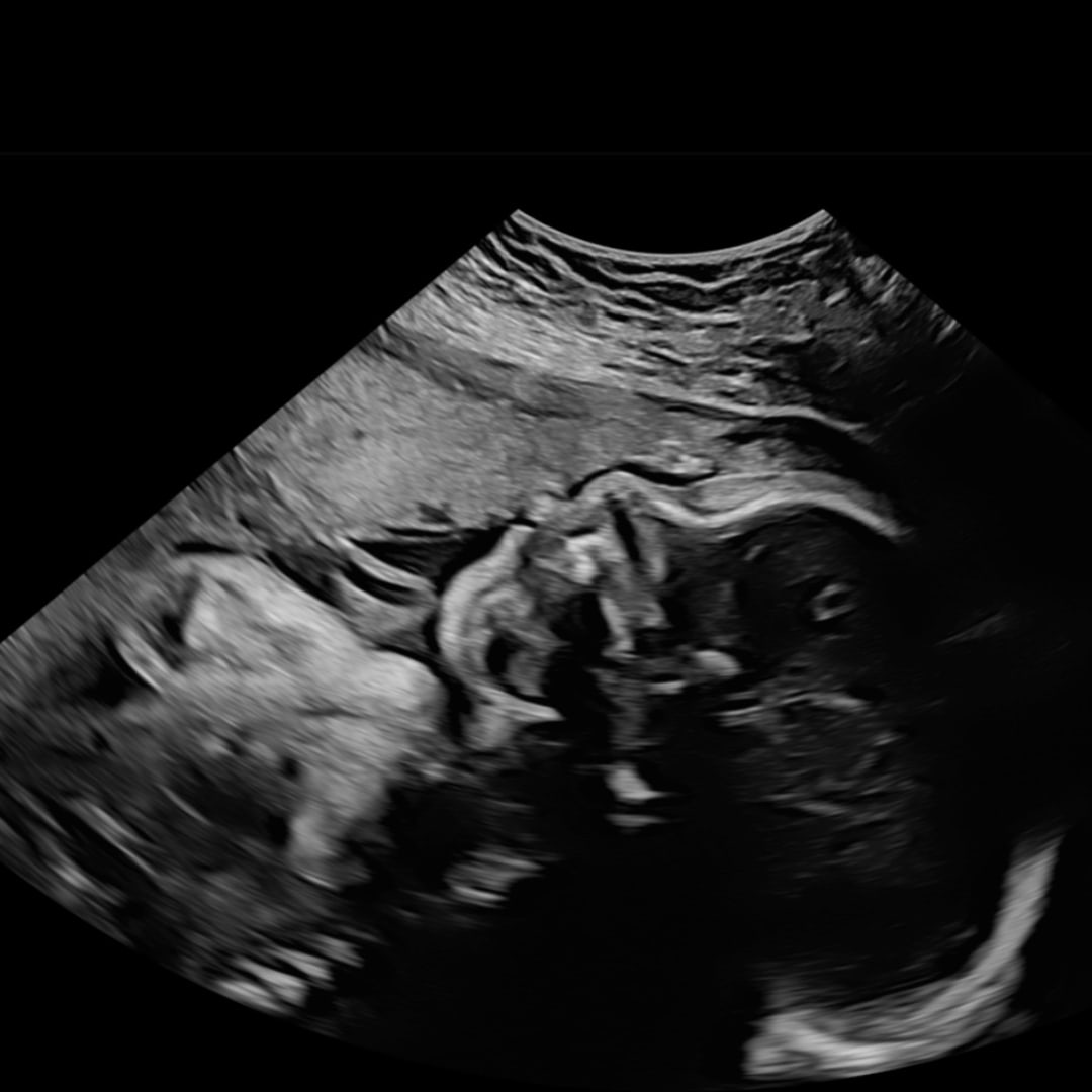 Photo shared by Maddi for their Babylist baby registry.