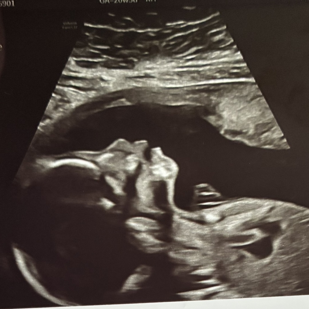 Photo shared by Gem for their Babylist baby registry.